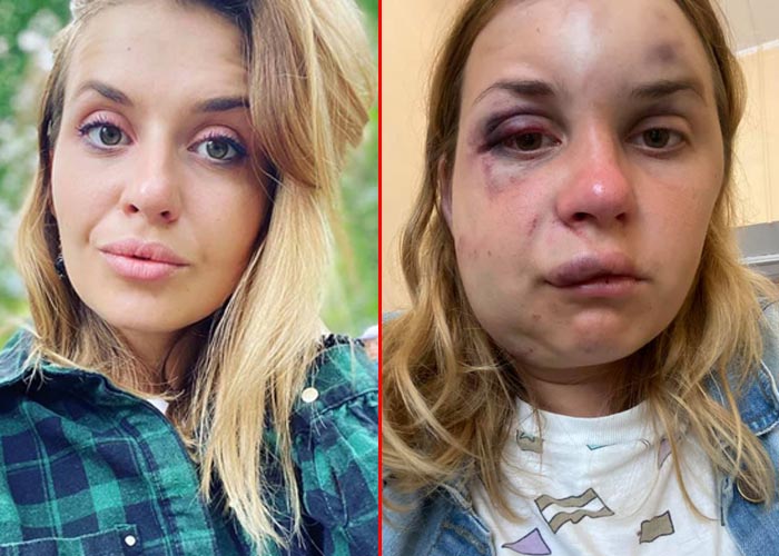 Анастасия Луговая до и после попытки изнасилования