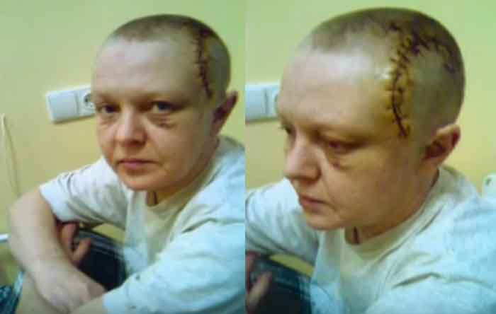 Маргарита Сергеечева после операции