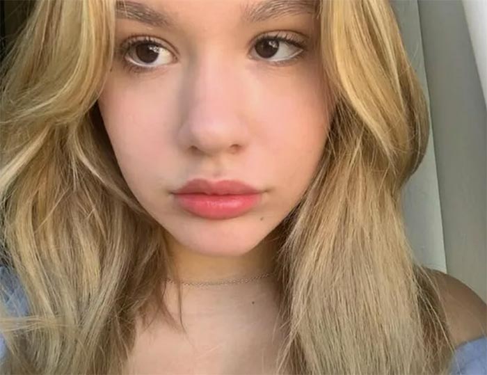 Полина Аксенова после пластики