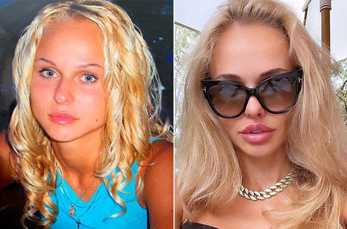 Надежда Санько до и после пластики