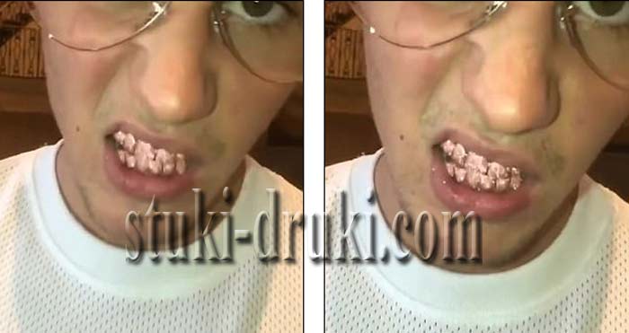 Джастин Бибер розовые сапфировые зубы