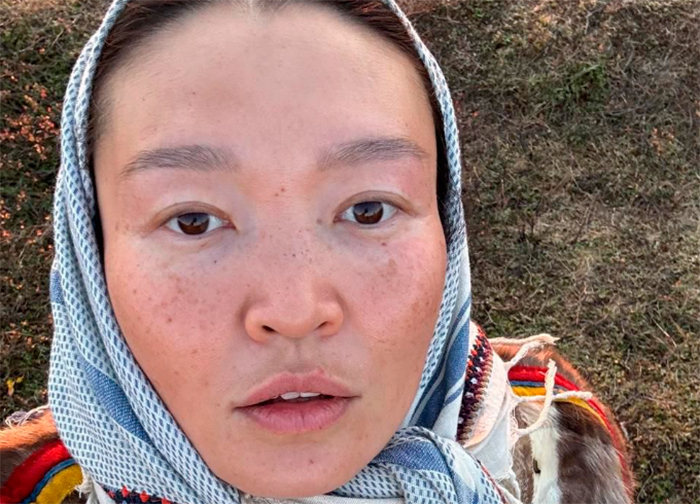 кадр Цинга 5